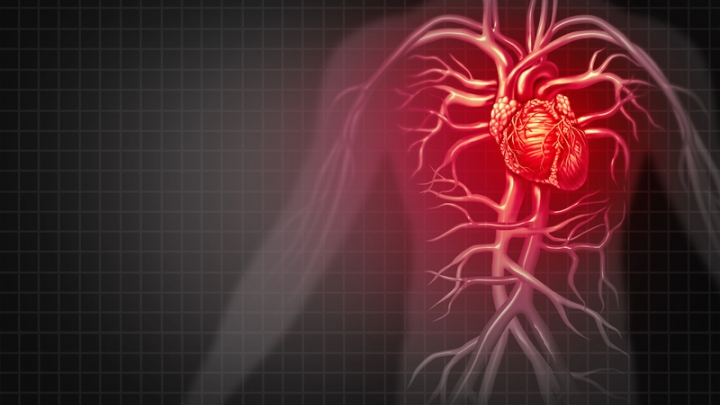 Heart Attack Symptoms: Men vs. Women